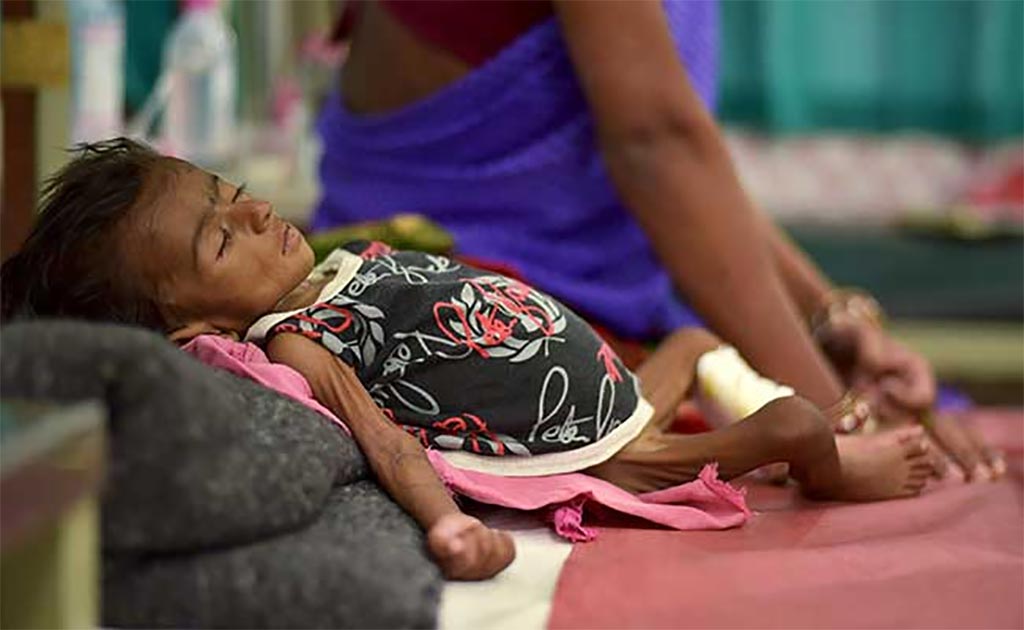 1.26 Million Children Under 5 Die In India Every Year, Admits Government