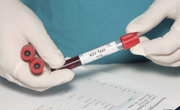 Same Day HIV AIDS Treatment World Health Organisation WHO Same Day HIV AIDS Treatment World Health Organisation WHO