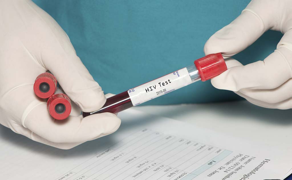 Initiating Same-Day HIV Treatment Better For Patients: Study