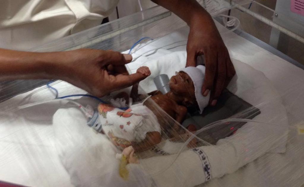 This Preemie Weighed As Much As A Cellphone. Then A Hospital Worked Its Magic