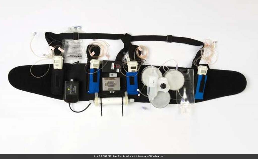 Wearable Artificial Kidney Could Replace Conventional Dialysis