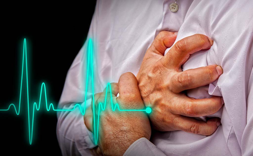 Gallstone Disease May Increase Heart Disease Risk: Research