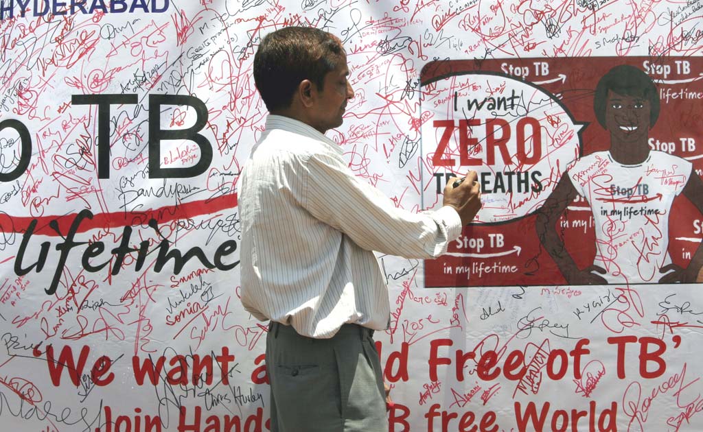 Tuberculosis Cases In India May Be 3 Times Higher Than Estimated: Study