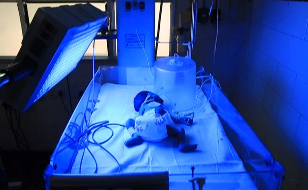 Doctor Sheds Light On Top Cause Of Childhood Blindness In India