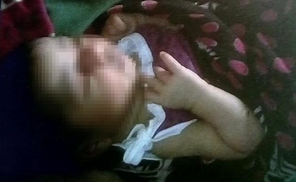 Newborn In Kolkata Given Wrong Injection. Nurse Says, 'By Mistake'