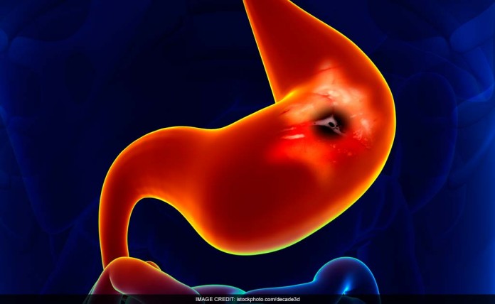 stomach1