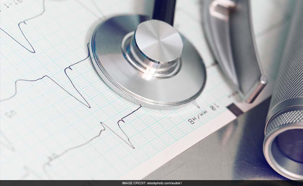 Irregular Heartbeat May Cause Serious Health Issues: Study Irregular Heartbeat May Cause Serious Health Issues: Study
