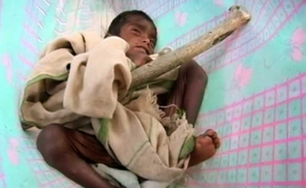 After Malnourishment Deaths, Sheopur&rsquo;s Nutrition Centres In Madhya Pradesh Overburdened