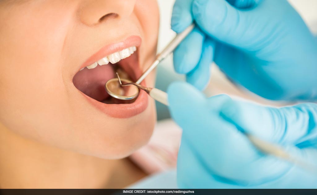 Eight Dental Fillings Can Up Mercury Levels In Blood: Study