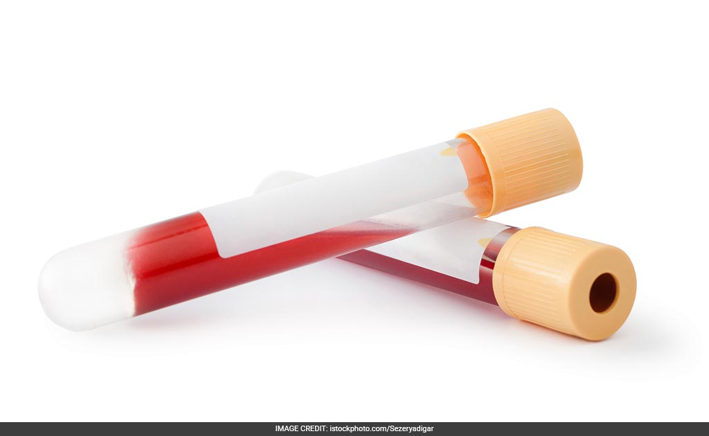 Lab-grown Blood Vessels To Help Kids With Heart Defects: Study