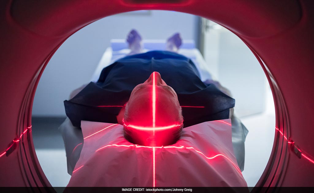 How Brain Zapping Could Decrease Psychiatric Symptoms: Study