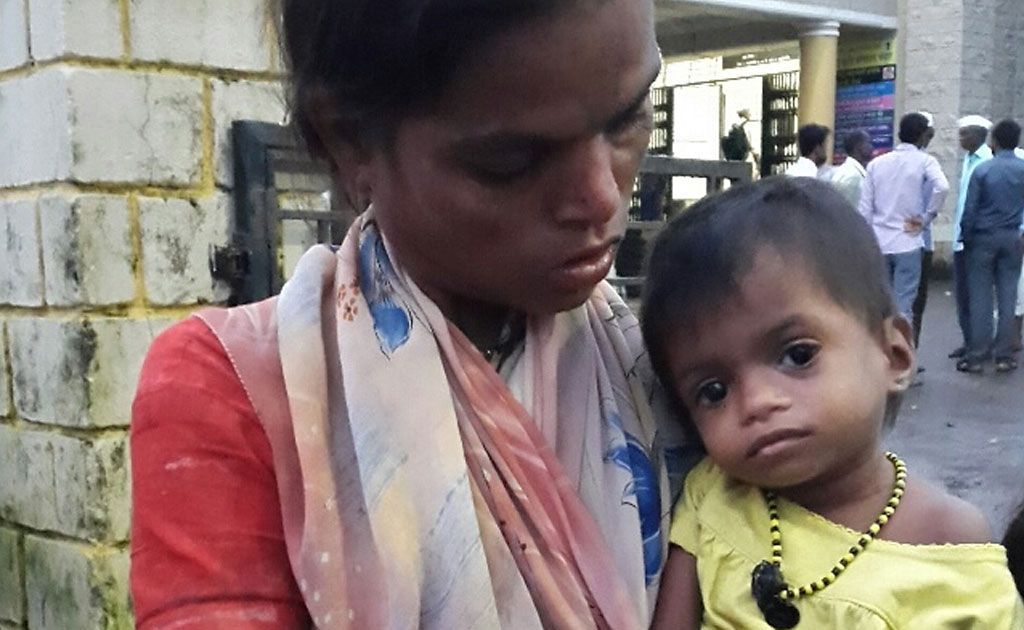 How Parents Struggle To Get Their Underweight Children Treated In Palghar