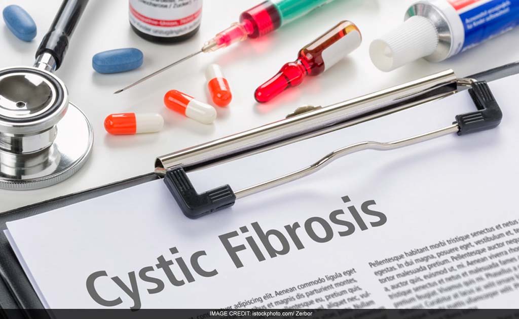 Life-threatening Superbug Can Spread In Cystic Fibrosis Patients: Study Life-threatening Superbug Can Spread In Cystic Fibrosis Patients: Study