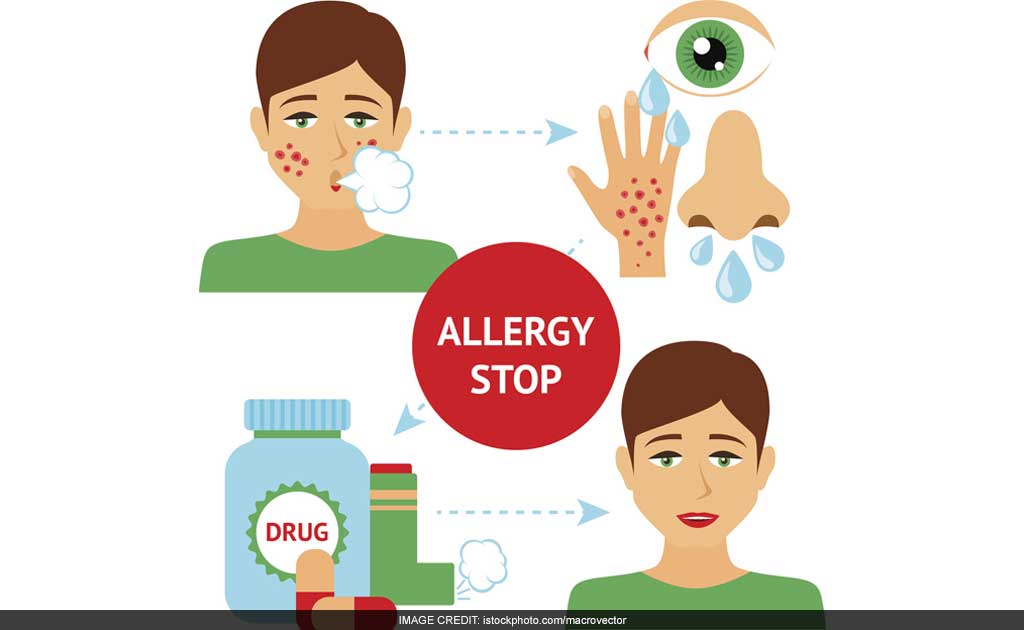 Scientists Develop A New Drug To Suppress Allergies, Asthma