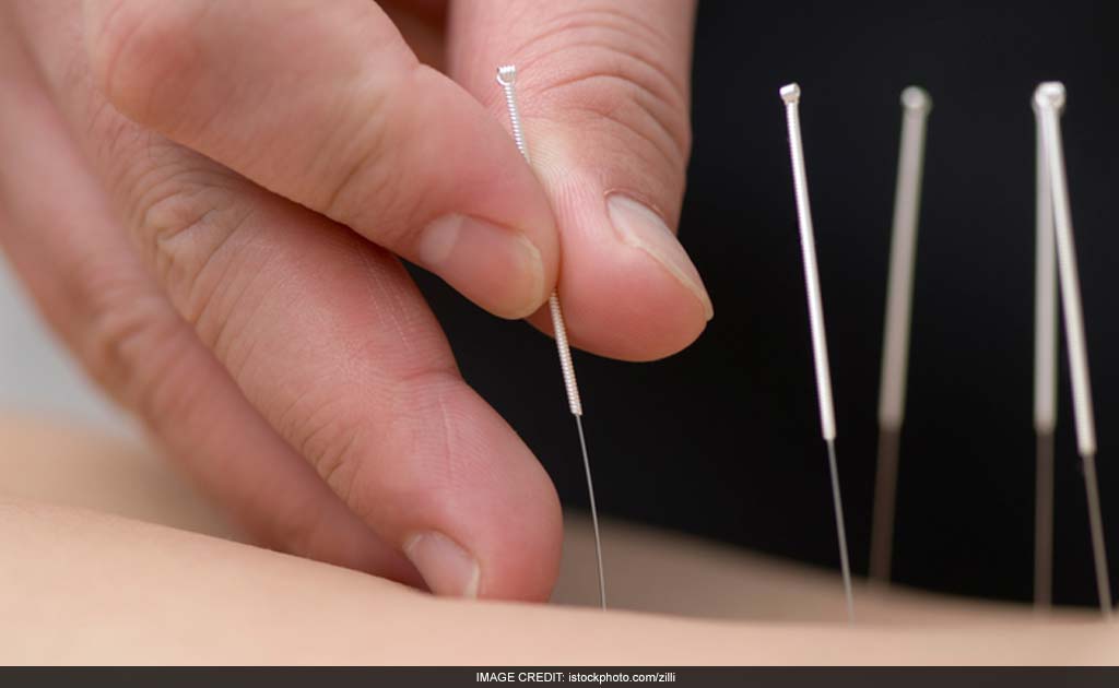 Electro-acupuncture May Improve Sleep In Breast Cancer Patients: Study