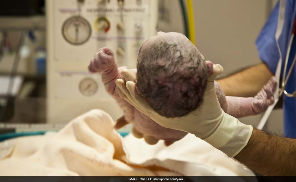 Caesarean Births May Be 'Affecting Human Evolution': Study