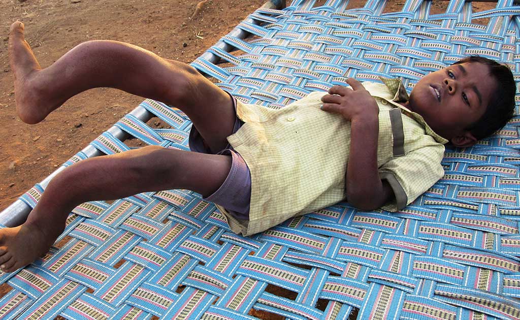 Fluorosis: A Vicious Disease, But There Is Hope