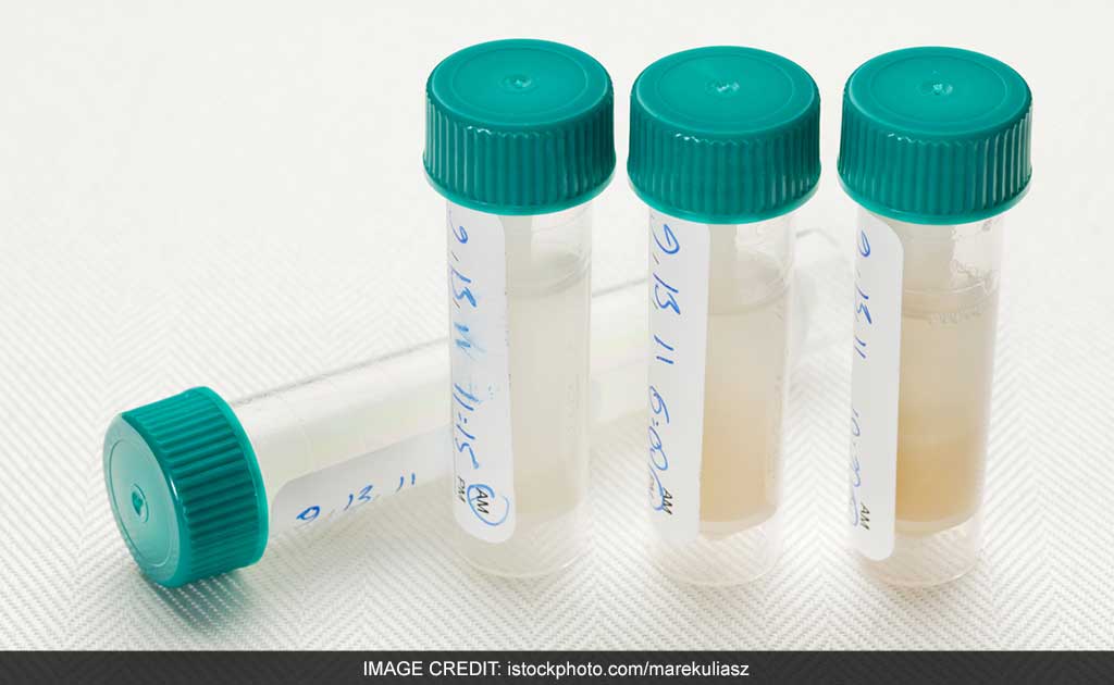 Cheap Saliva Test May Determine Immunity Status In Body: Study