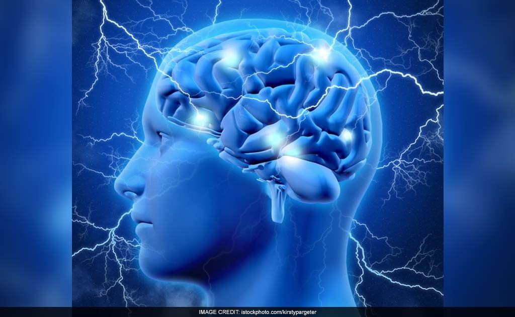 Afbeeldingsresultaat voor brain activity