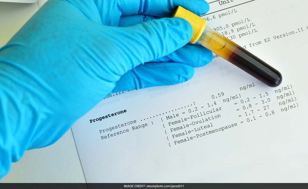 New Blood Test May Improve Treatment For Ovarian Cancer Patients: Scientists