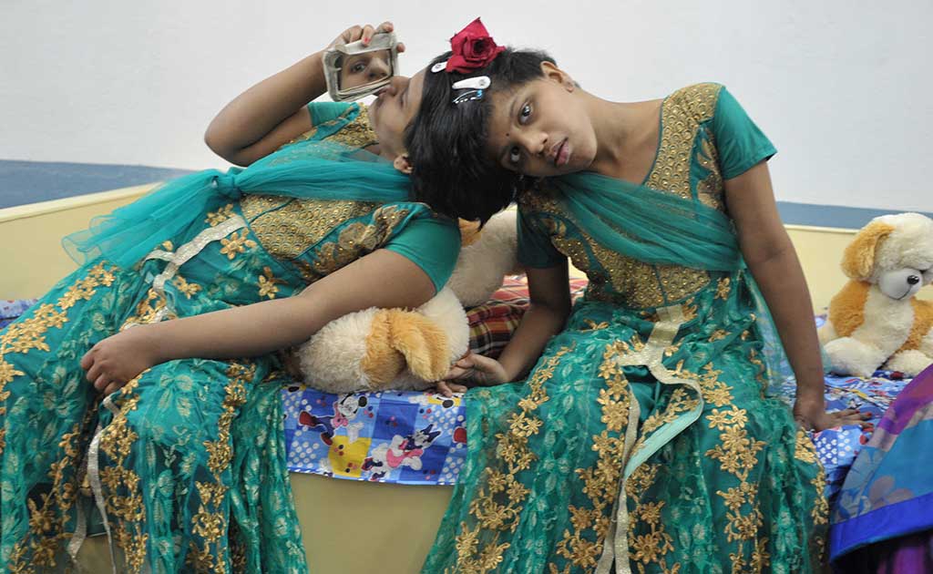 Veena and Vani: Joined By Birth And Destiny