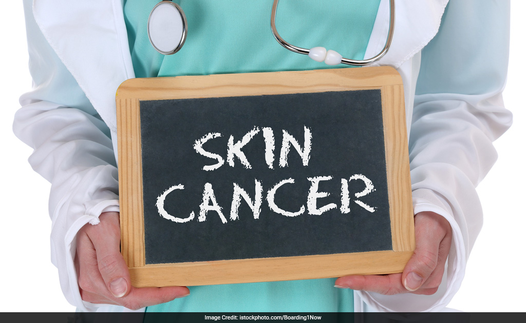 New Drug May Reduce Skin Cancer Spread By 90 Per Cent: Study New Drug May Reduce Skin Cancer Spread By 90 Per Cent: Study