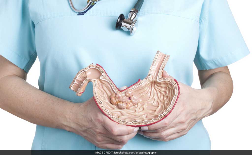 Thick Skin On Palms, Soles Linked To Oesophageal Cancer: Study