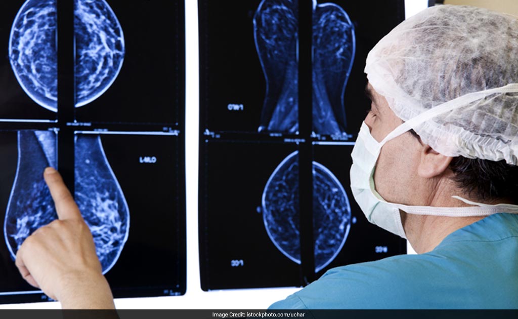 In India, 70% Cancer Patients Seek Medical Attention At Last Stage, Say Doctors In India, 70% Cancer Patients Seek Medical Attention At Last Stage, Say Doctors