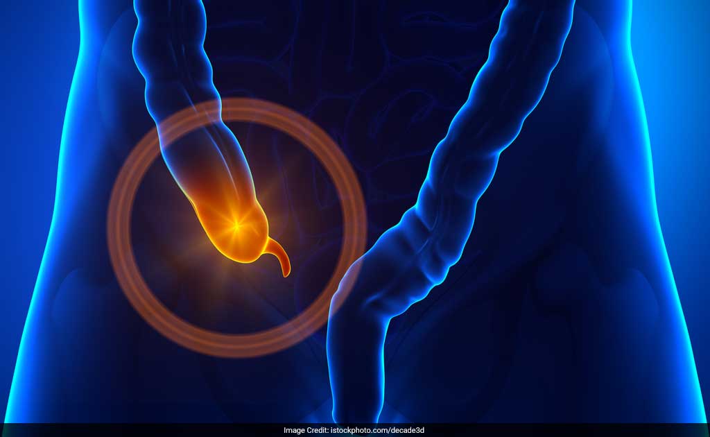 Antibiotics Could Replace Surgery As Appendicitis Treatment: Study