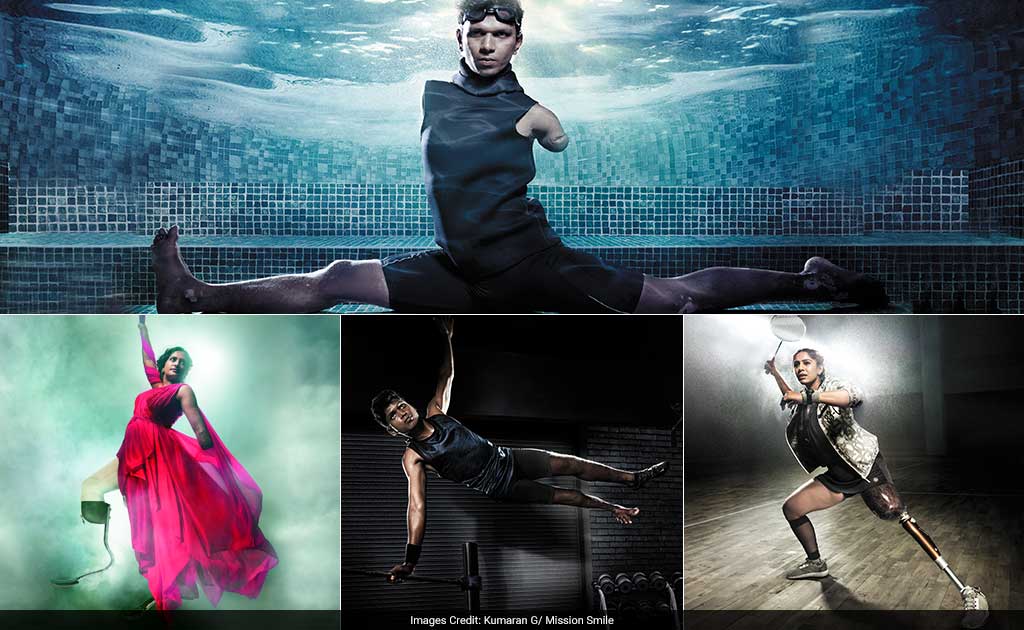 13 Amputees Break Beauty Stereotype, Are Now Calendar Girls And Boys