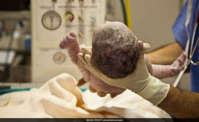 Late Marriages, Sedentary Lifestyle Increase The Chances Of Caesarean Deliveries, Say Doctors