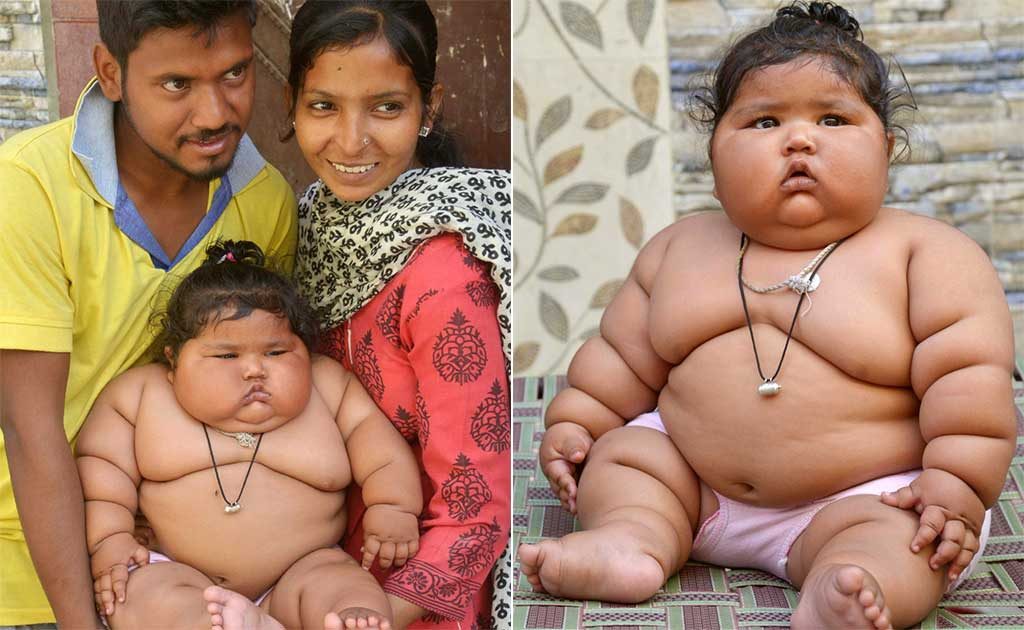  Unbelievable The Astounding Story Of The Heaviest 5 year old Girl In 