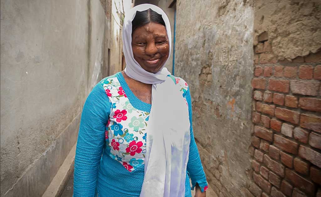 9 Years, 19 Surgeries. This Survivor Decides To Not Give Up