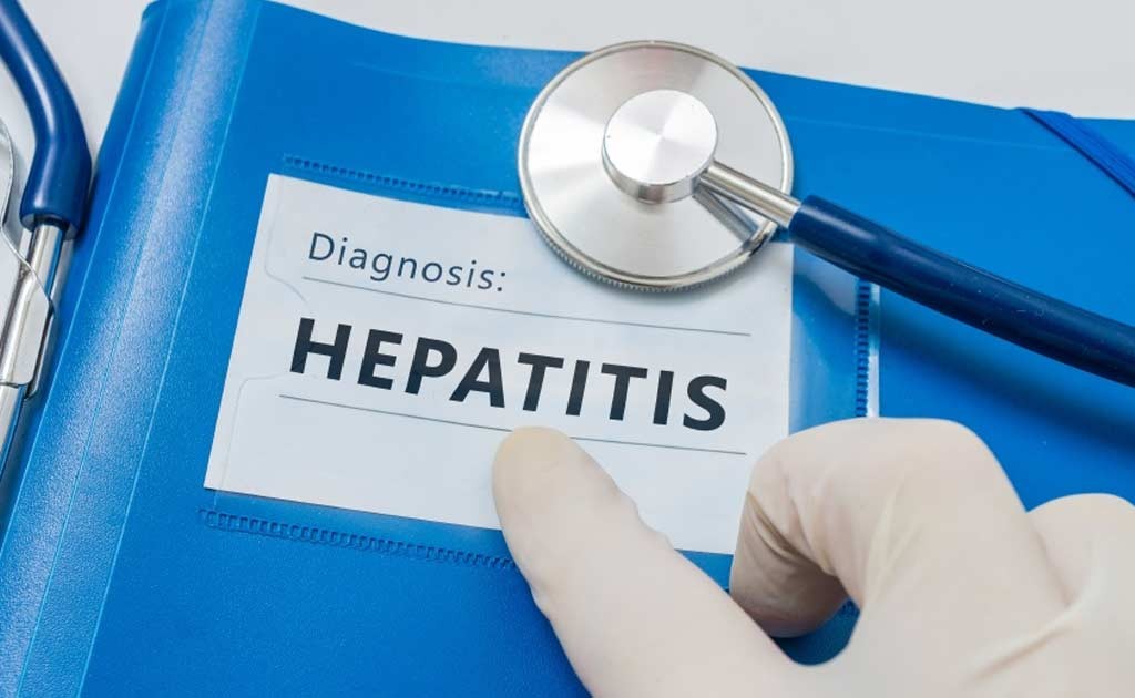 Hepatitis C Drugs In India Are Cost Effective, Shows Study Hepatitis C Drugs In India Are Cost Effective, Shows Study