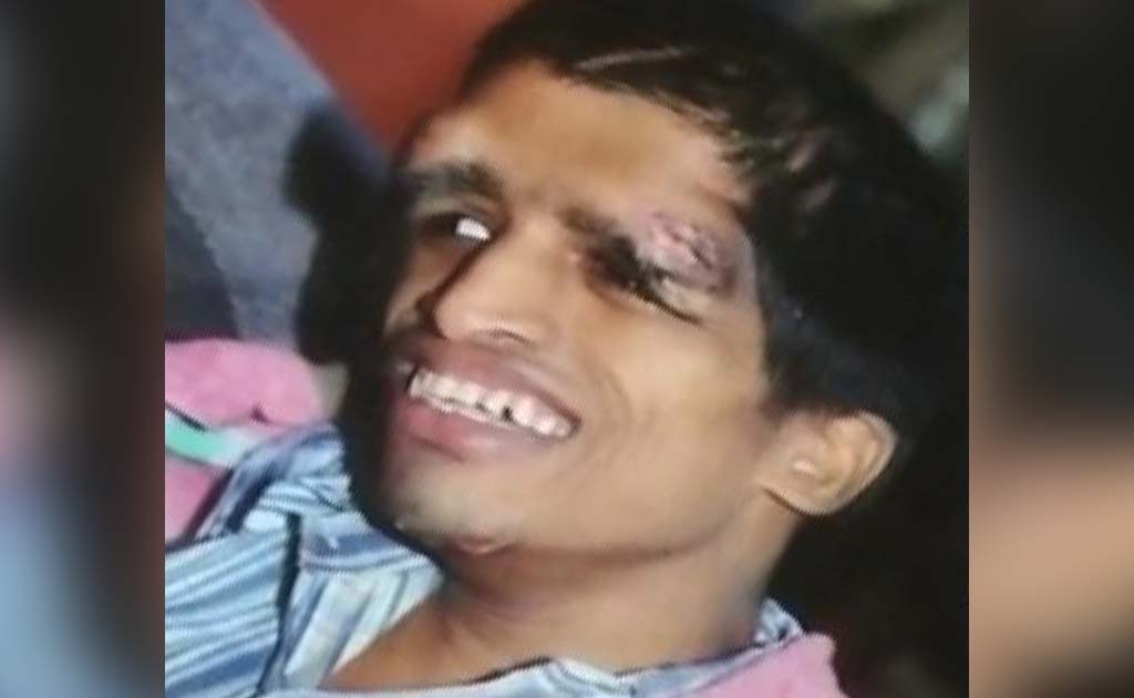 Blinded, Deformed, Thousands Paying For Endosulfan In Karnataka Say &lsquo;Enough&rsquo;