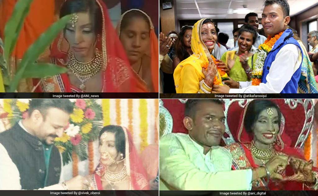 Wrong Number Led Acid Attack Survivor To Mr Right