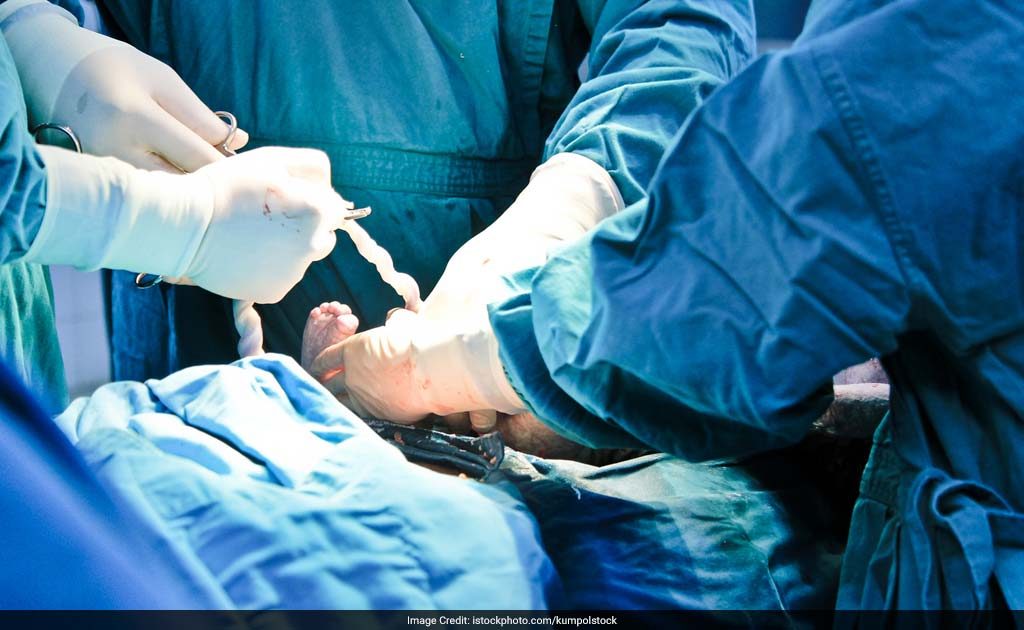 Forceps, Vacuum Deliveries More Traumatic Than C-section, Shows Study
