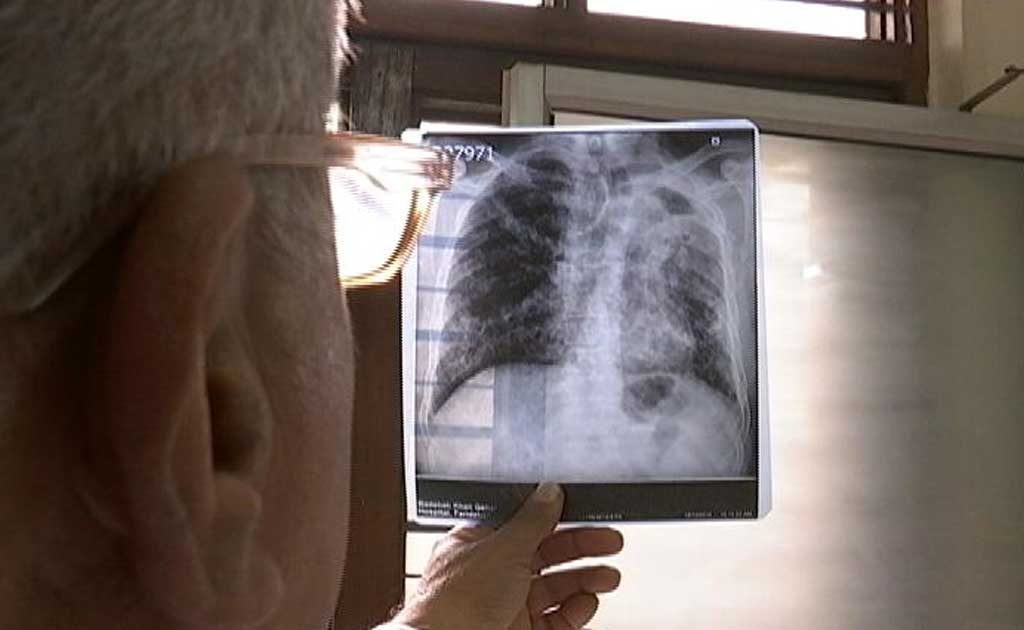 In Mumbai, TB Deaths Spark Data Dispute
