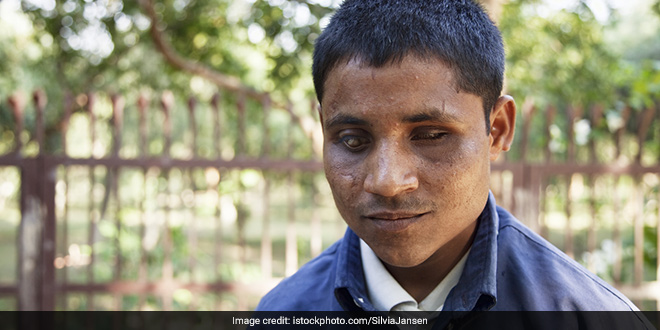 Donate Eye As Every Fifth Blind Person In The World Is An Indian | Feature