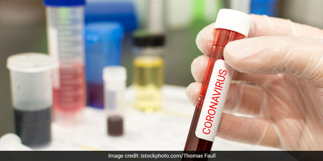 Blood Clots, Lung Injuries Found In Patients Who Have Died Of COVID-19: Study