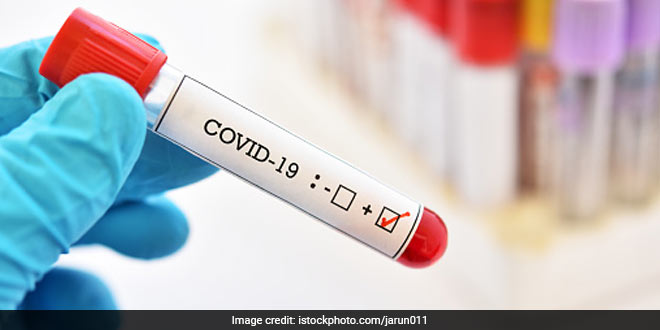 Antibodies Against Coronavirus Stay In Body For At Least 60 Days: Study