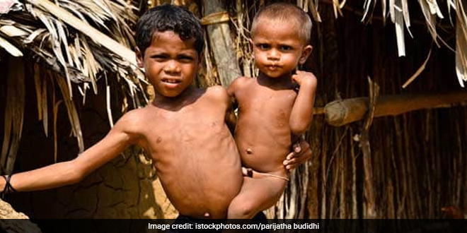 Opinion | Building India's Human Capital Amid Persistent Child Malnutrition