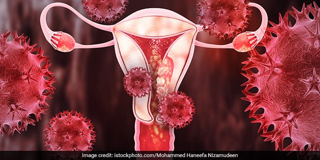 महिलाओं में बढ़ रहे हैं सर्वाइकल कैंसर के मामले, जानें लक्षण, बचाव से लेकर इलाज की पूरी डिटेल
