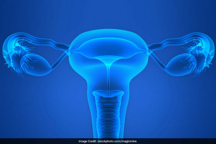 1 In 5 Women In India Have Polycystic Ovarian Syndrome, Here’s What You Need To Know About The Disorder