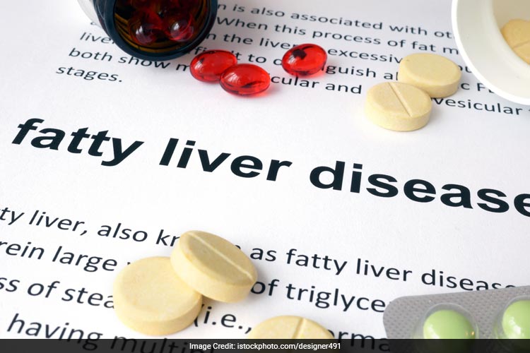 Avoid processed and junk food to maintain a healthy liver